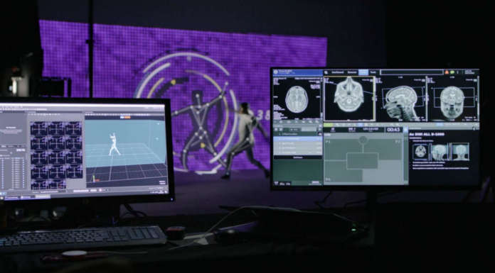 GE HealthCare velocizza l’acquisizione di immagini di risonanza magnetica con l’AI