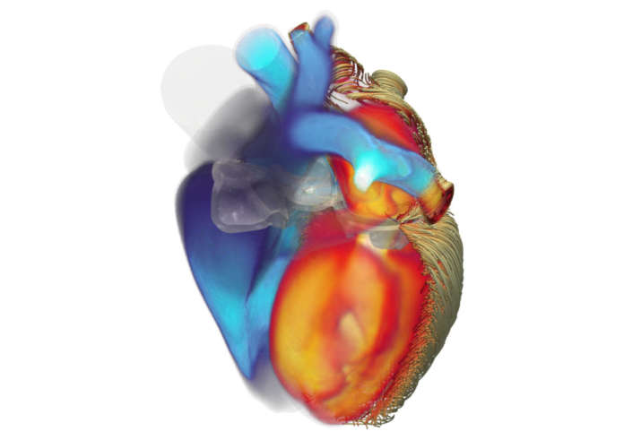 iHEART Simulator Politecnico di Milano