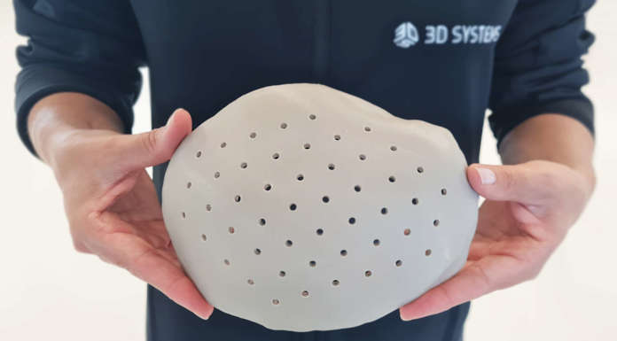 3D Systems: l’FDA autorizza gli impianti cranici in PEEK stampati in 3D